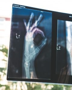 Citiscan imaging result showing hand in the &ldquo;Okay&rdquo; sign; image by Owen Beard, via Unsplash.com.